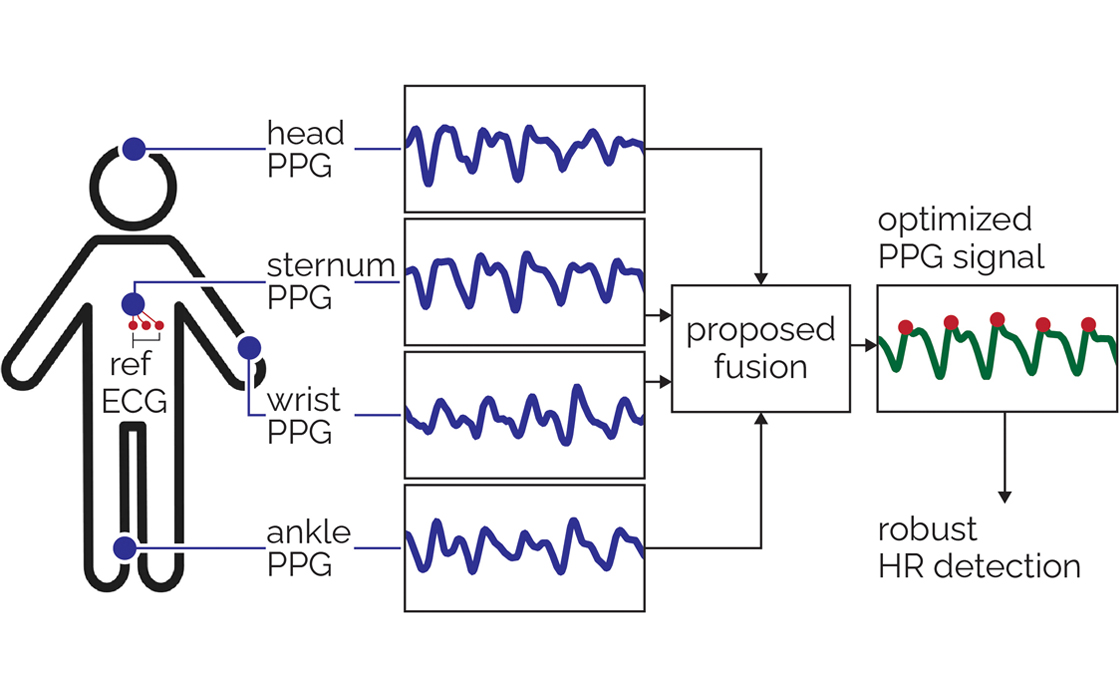 Robust Heart Rate Detection via Multi-Site Photoplethysmography illustration